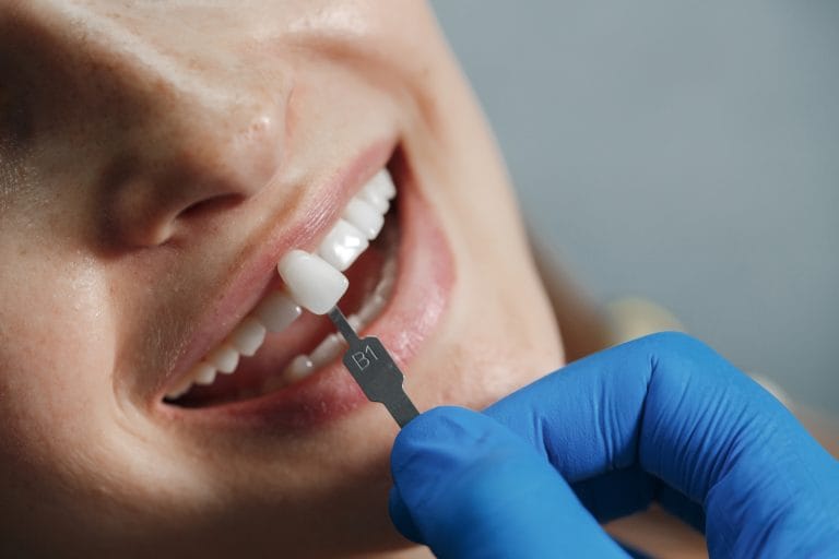 Durable Dental Crowns in Warnbro